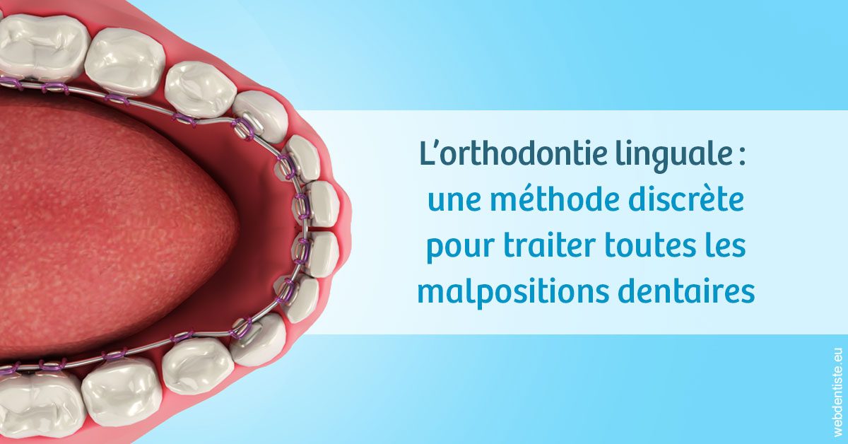 https://dr-patrick-missika.chirurgiens-dentistes.fr/L'orthodontie linguale 1