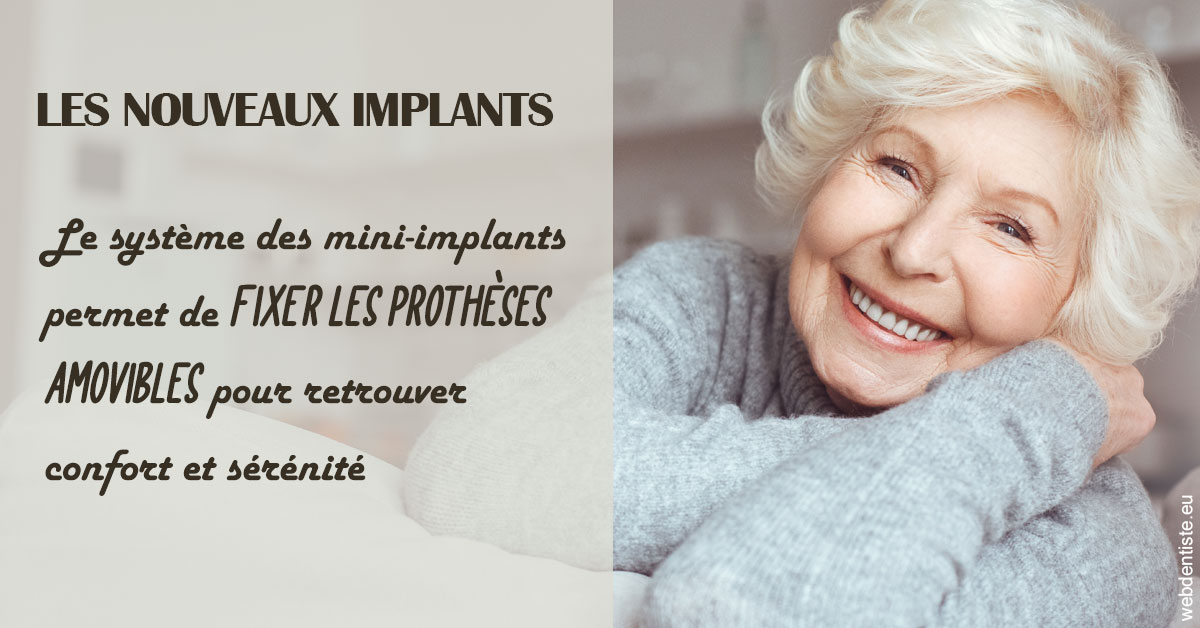 https://dr-patrick-missika.chirurgiens-dentistes.fr/Les nouveaux implants 1