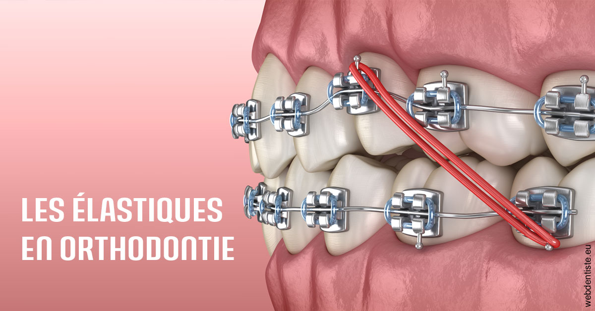 https://dr-patrick-missika.chirurgiens-dentistes.fr/Elastiques orthodontie 2