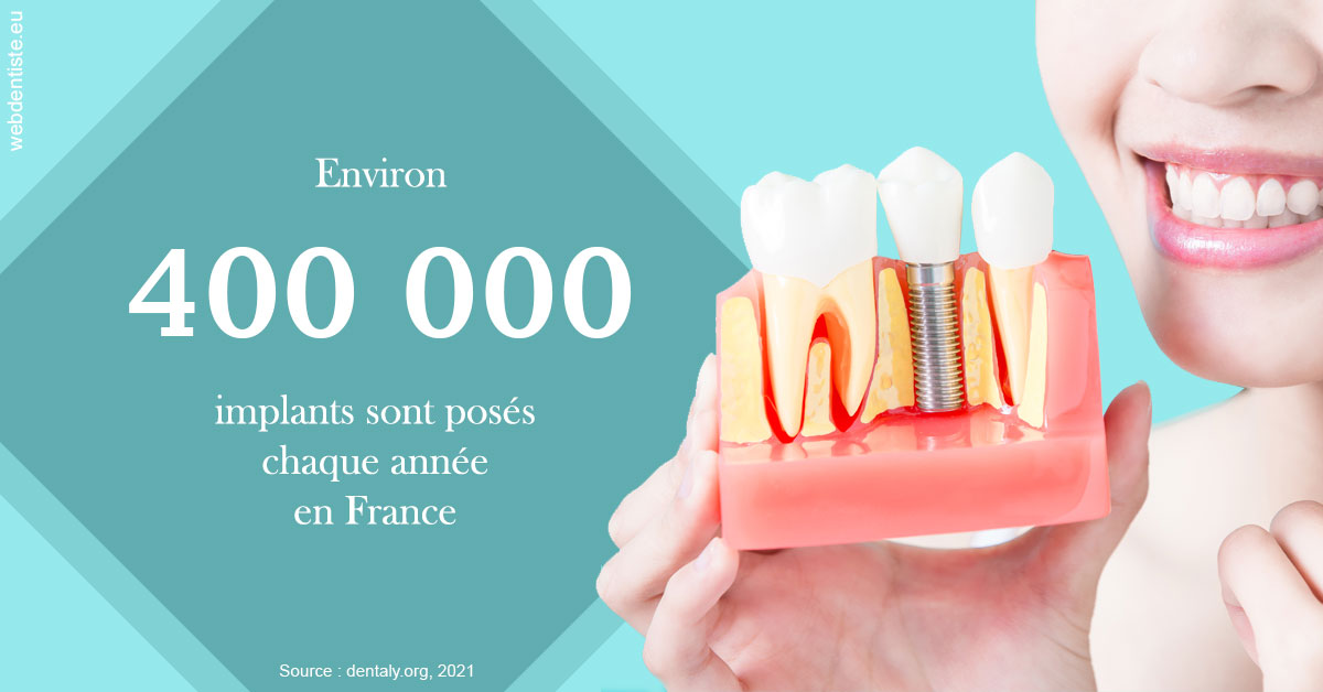 https://dr-patrick-missika.chirurgiens-dentistes.fr/Pose d'implants en France 2